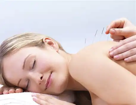 Acupuntura a domicilio o en consulta